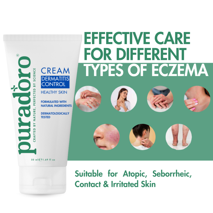 Crema Dermatite & Pelle Sana – Lenisce prurito, arrossamento e desquamazione 50ml - immagine 5